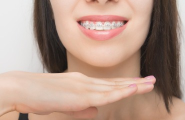 aparat dentar